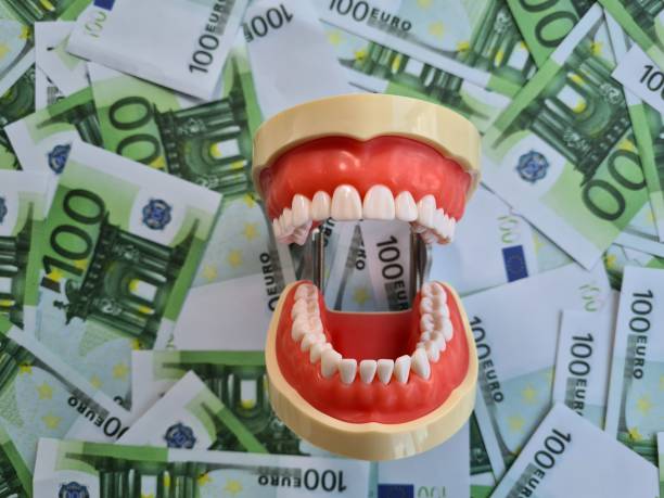 how much do veneers cost